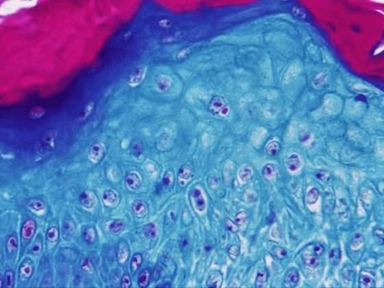 Secretaría de Salud emite aviso epidemiológico de viruela del mono 17 viruela del mono